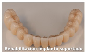 implanto-soportado-clinica-somosaguas-pozuelo-alarcon