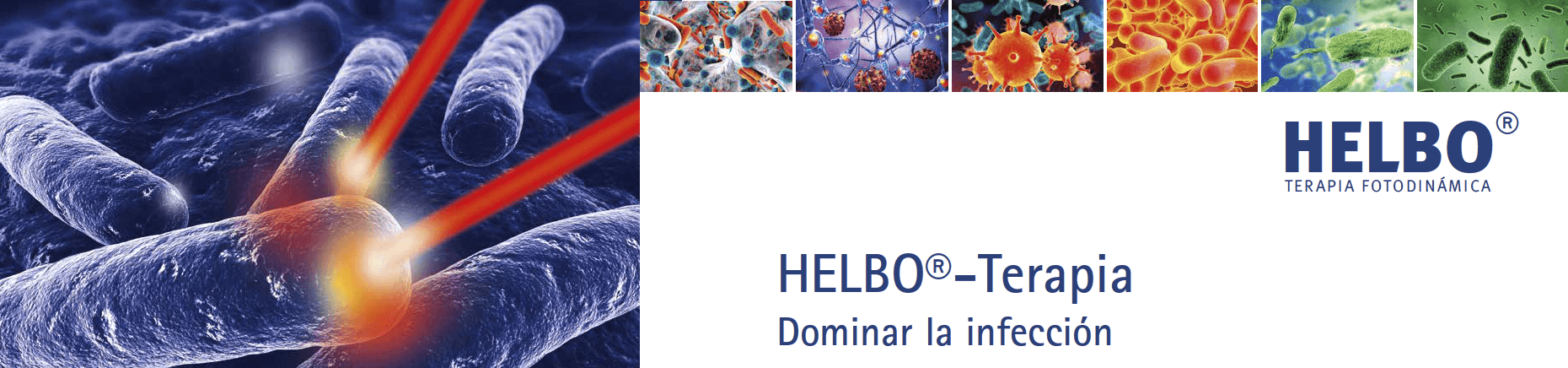 helbo-terapia-fotodinamica-pozuelo-alarcon